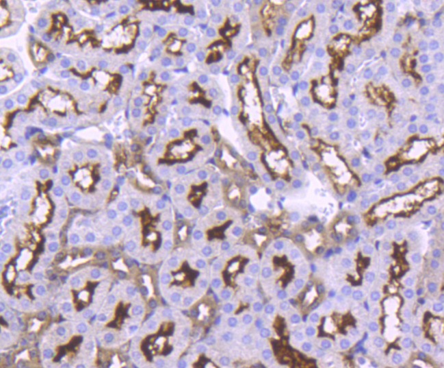 Anti-ACE2/ACEH Antibody (3P140)