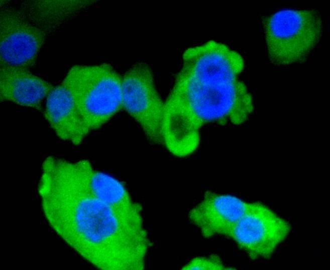 Anti-AMPK α1 Antibody (7H670)
