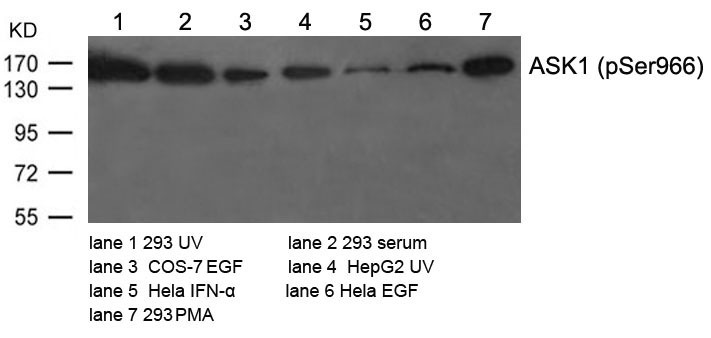 Anti-Phospho-ASK1 (Ser966) Polyclonal Antibody