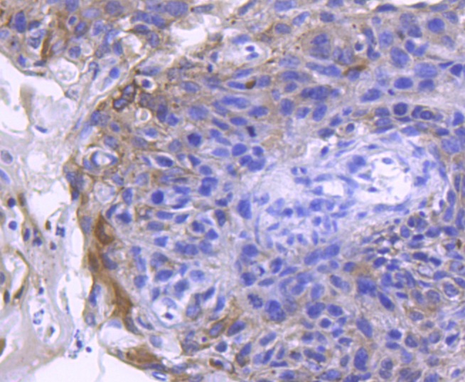 Anti-ACE2/ACEH Antibody (3P140)