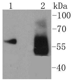 Anti-Asparagine synthetase Antibody (3D193)