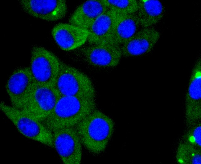 Anti-ACE2/ACEH Antibody (3P140)