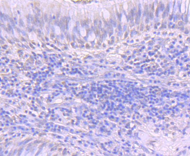 Anti-ATF1 Antibody (7A32)