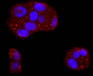 Anti-ASPP2 Antibody (2W253)