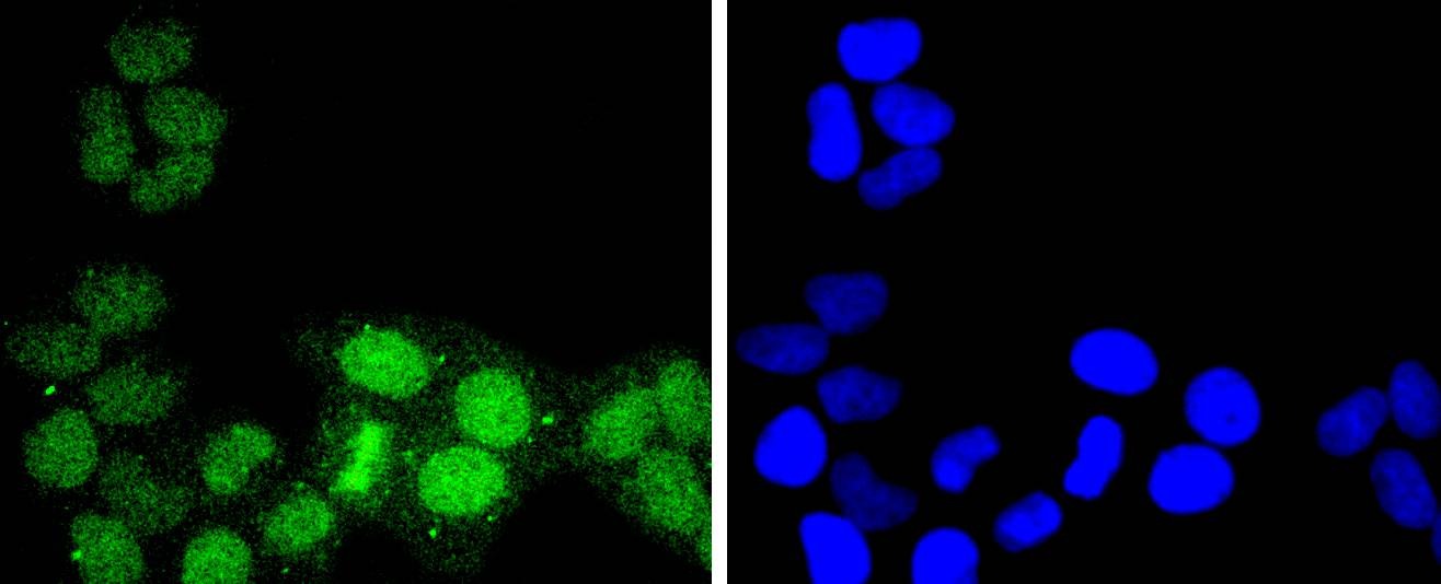 Anti-ATF1 Antibody (7A32)
