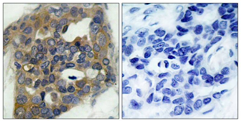 Anti-Phospho-ASK1 (Ser966) Polyclonal Antibody