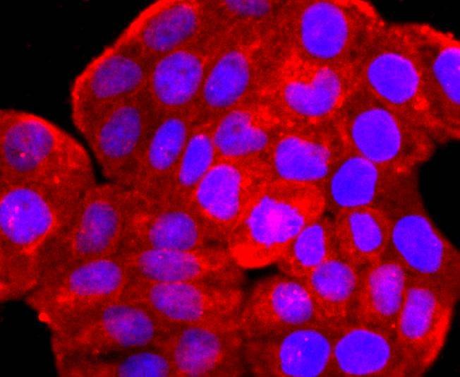 Anti-ARF6 Antibody (4X904)