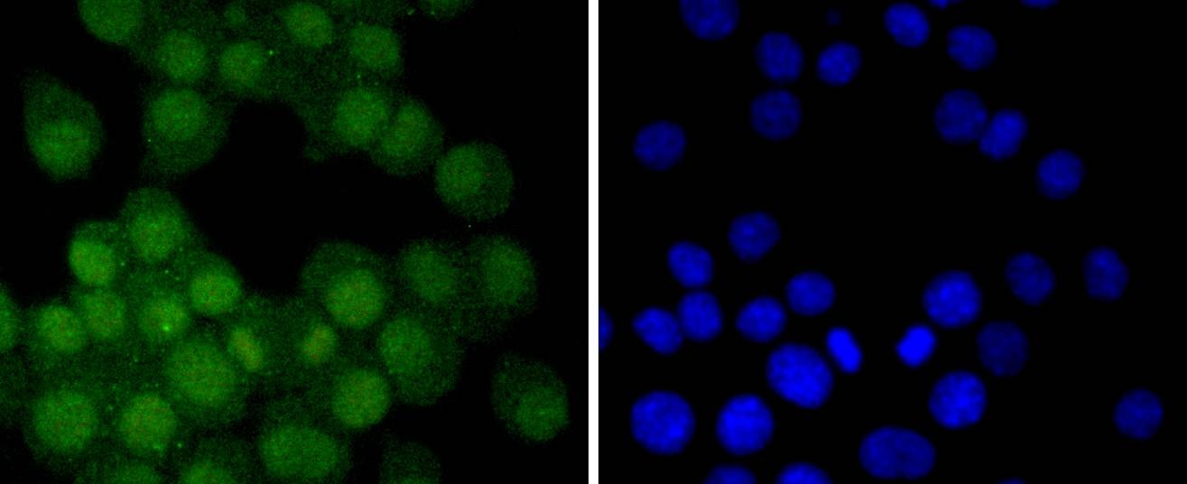 Anti-Androgen receptor Antibody (3T582)