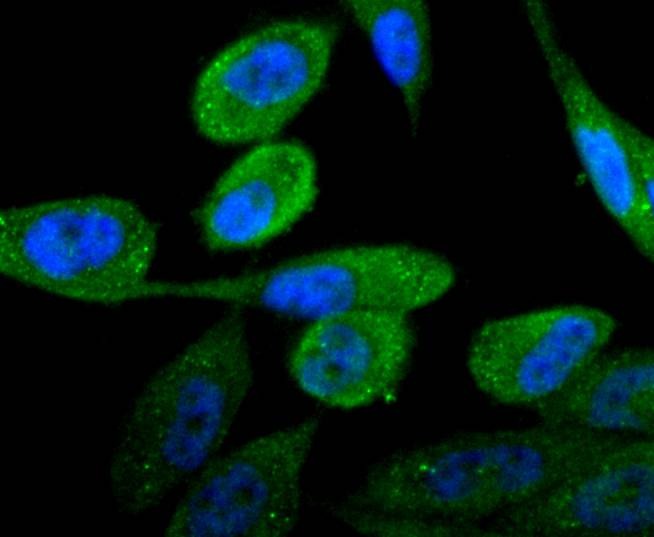 Anti-Androgen receptor Antibody (3T582)