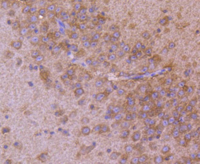 Anti-AP2M1 Antibody (9R605)