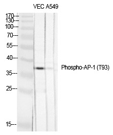 Anti-Phospho-JUN (Thr93) Polyclonal Antibody 2