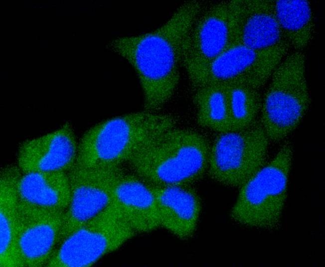 Anti-Alpha/Beta-Synuclein Antibody (5Q165)