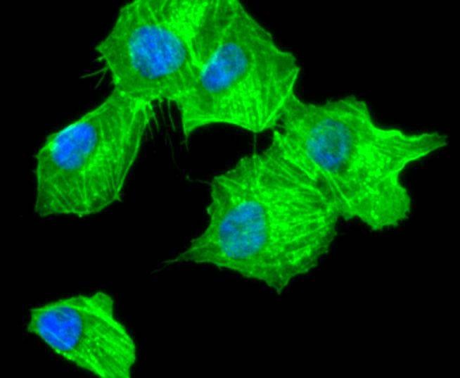 Anti-ACTA2 Antibody (3G548)