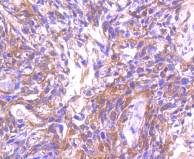Anti-ASK1 Antibody (3O802)