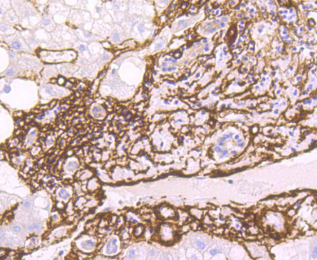 Anti-ACTA2 Antibody (3G548)