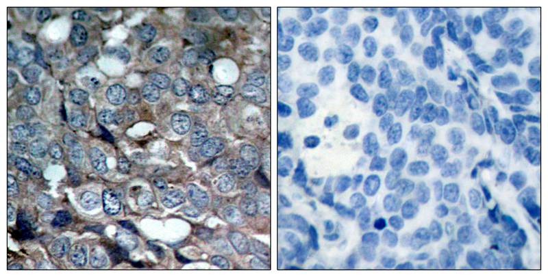 Anti-Phospho-ASK1 (Ser83) Polyclonal Antibody