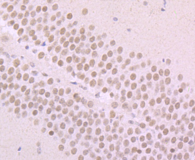 Anti-Alpha-Synuclein Antibody (2M749)