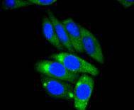 Anti-AP2M1 Antibody (9R605)