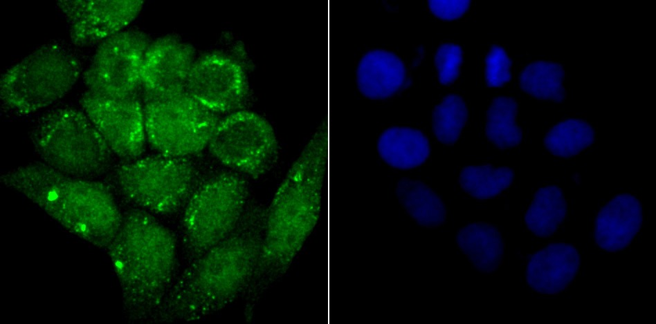 Anti-Alpha-Synuclein Antibody (2M749)