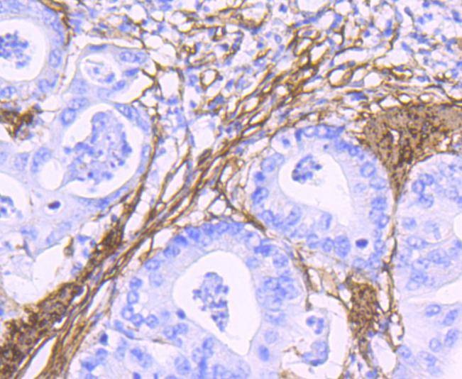 Anti-ACTA2 Antibody (3G548)