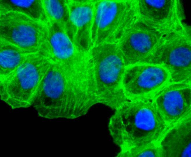 Anti-ACTA2 Antibody (3G548)