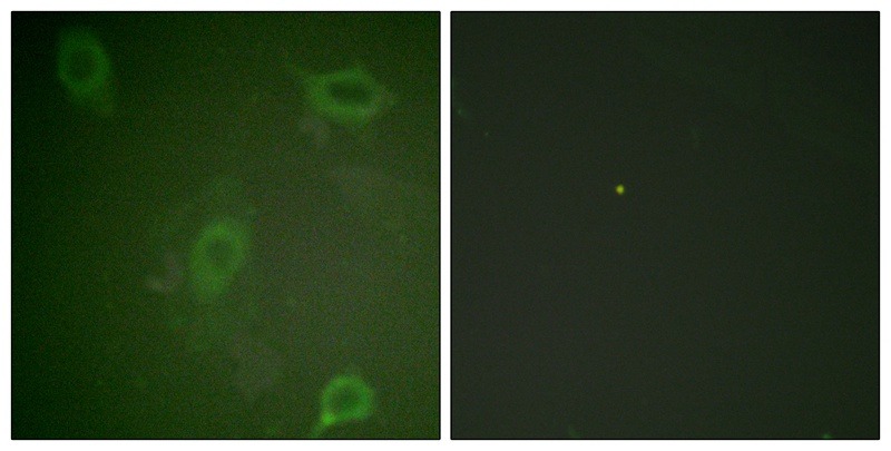 Anti-Phospho-APP (Thr743, 668) Polyclonal Antibody