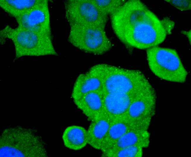 Anti-ASK1 Antibody (3O802)
