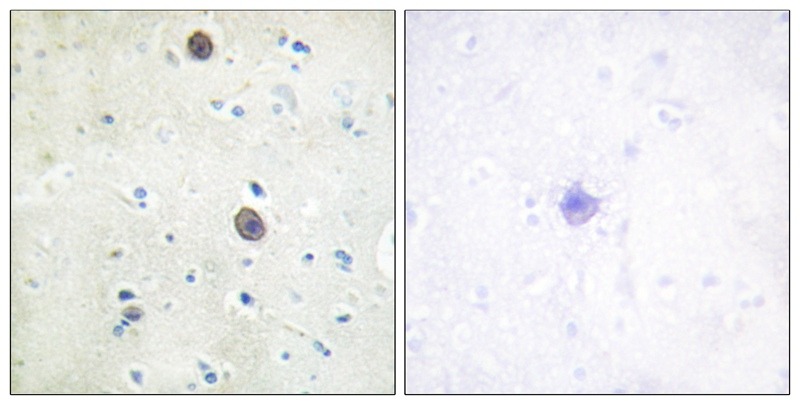Anti-Phospho-APP (Thr743, 668) Polyclonal Antibody