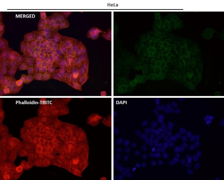Anti-Alkaline Phosphatase/ALPL Antibody (3F463)