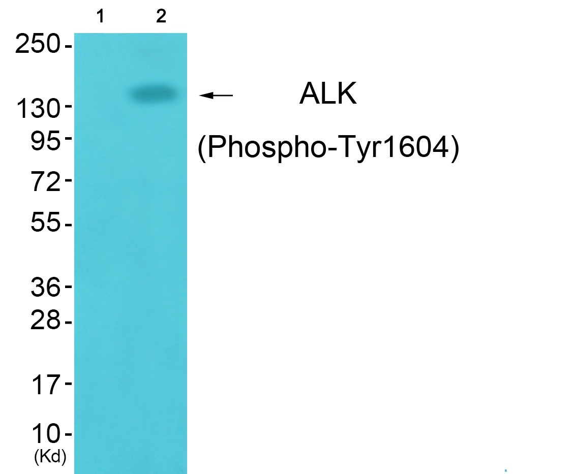 Anti-Phospho-ALK (Tyr1604) Polyclonal Antibody