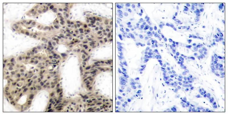 Anti-Phospho-4EBP1 (Thr46) Polyclonal Antibody