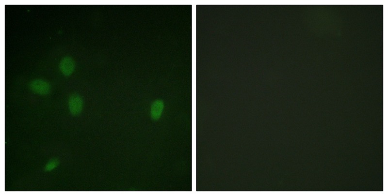 Anti-Phospho-53BP1 (Ser25) Polyclonal Antibody