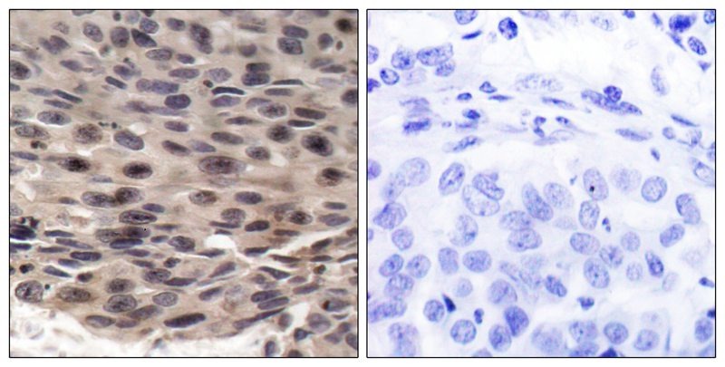 Anti-Phospho-4EBP1 (Thr37) Polyclonal Antibody