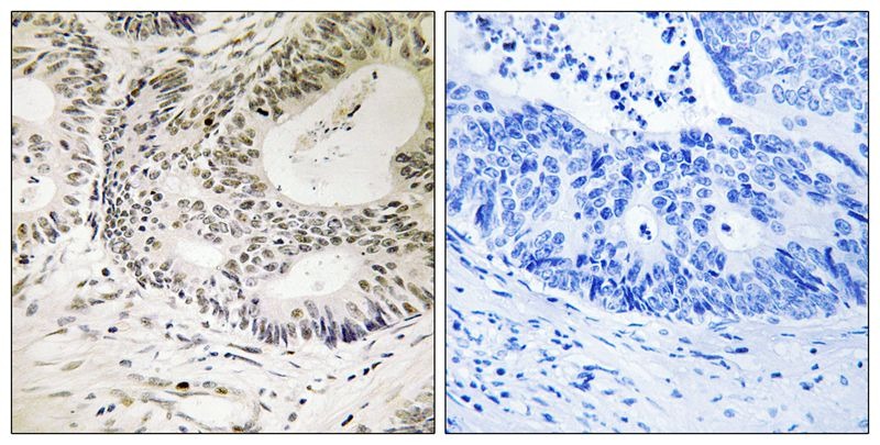 Anti-Phospho-53BP1 (Ser25) Polyclonal Antibody