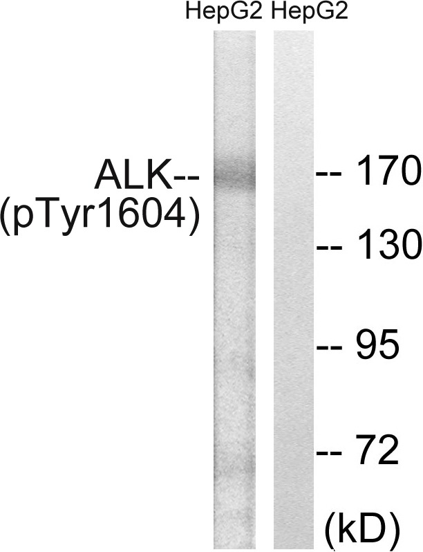 Anti-Phospho-ALK (Tyr1604) Polyclonal Antibody