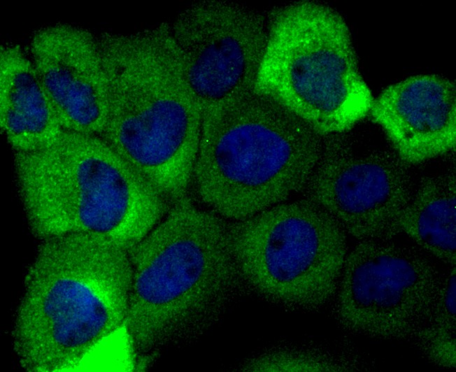 Anti-ALDOA Antibody (1Q763)