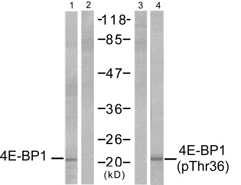 Anti-Phospho-4EBP1 (Thr37) Polyclonal Antibody