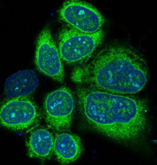 Anti-Alkaline Phosphatase/ALPL Antibody (3F463)