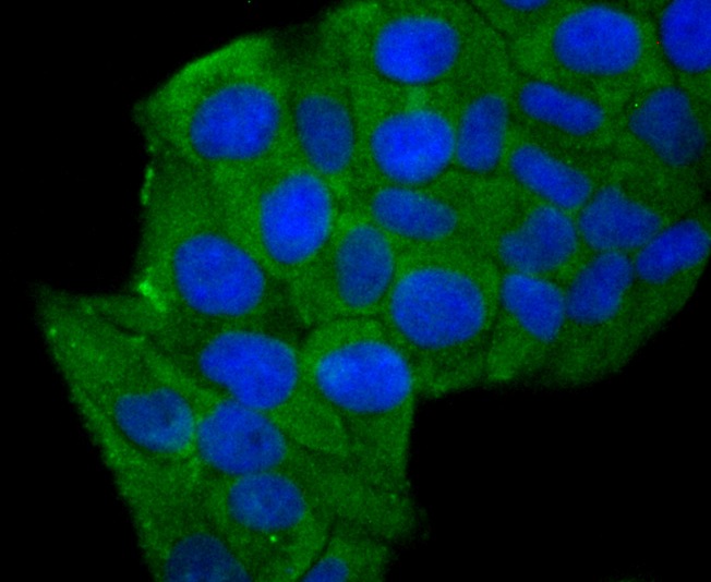 Anti-ALDOA Antibody (1Q763)