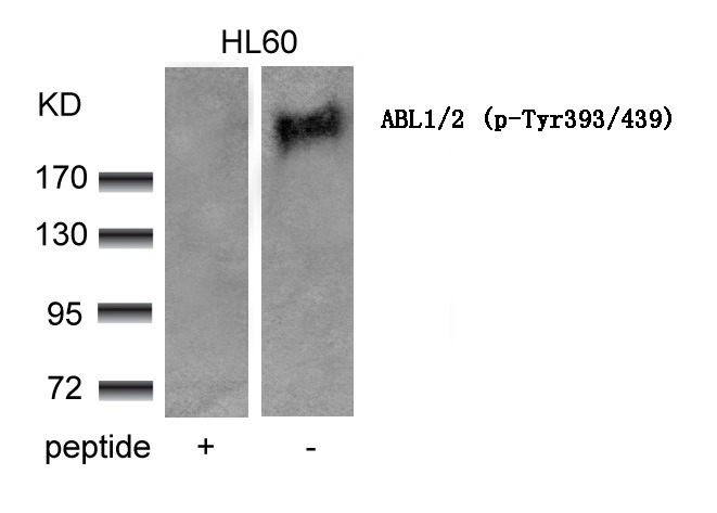 Anti-Phospho-C-ABL1/2 (Tyr393/439) Polyclonal Antibody