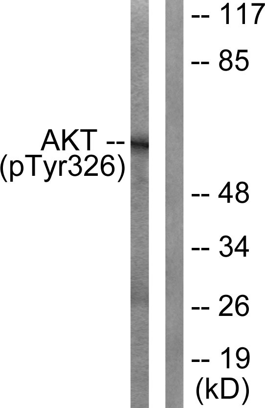 Anti-Phospho-AKT1 (Tyr326) Polyclonal Antibody