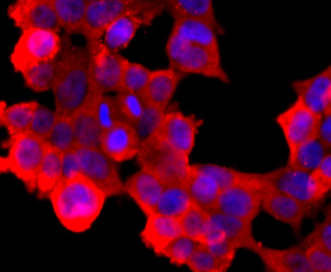 Anti-ABCG2 Antibody (4D379)