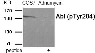 Anti-Phospho-C-ABL/ABL1 (Tyr204) Polyclonal Antibody 3