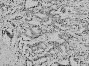 Anti-Acetyl-Lysine Antibody (3R56)