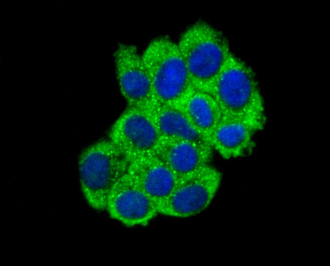 Anti-ABCF1 Antibody (8X278)