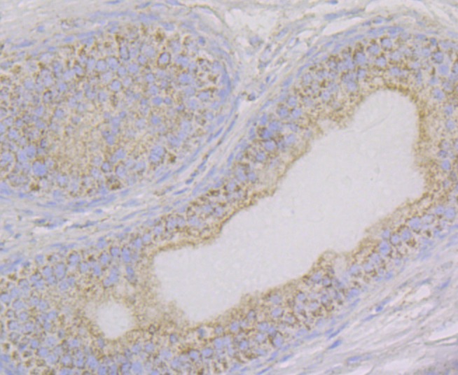Anti-Aconitase 2 Antibody (9R777)