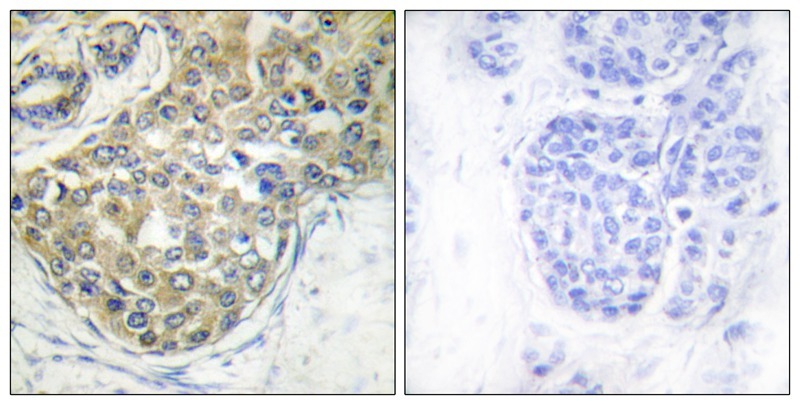 Anti-Phospho-ACK1 (Tyr284) Polyclonal Antibody