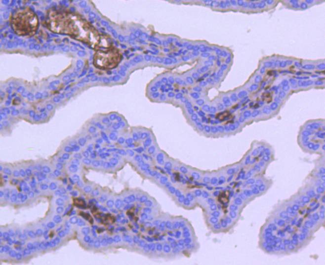 Anti-ACACA Antibody (9D736)