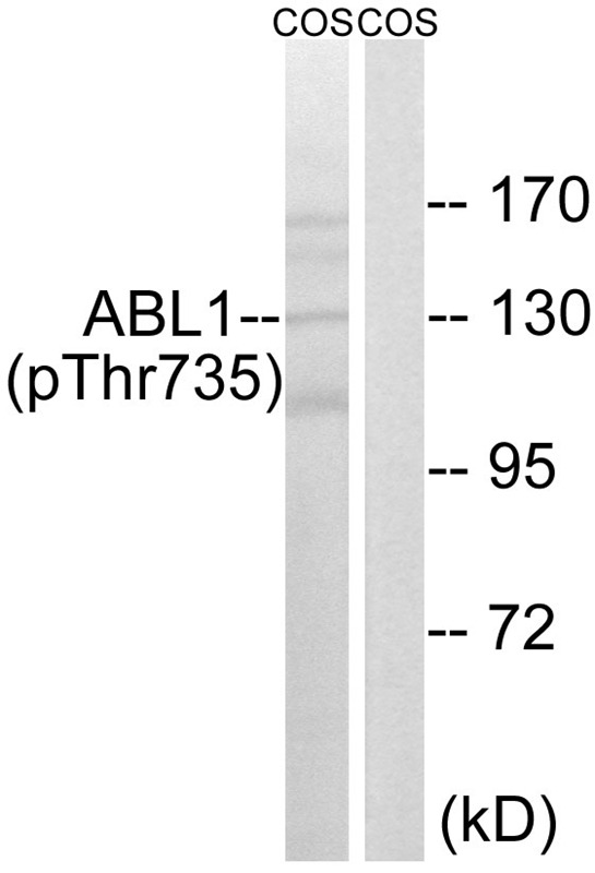 Anti-Phospho-C-ABL/ABL1 (Thr735) Polyclonal Antibody 2