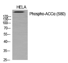 Anti-Phospho-ACACA (Ser80) Polyclonal Antibody 2